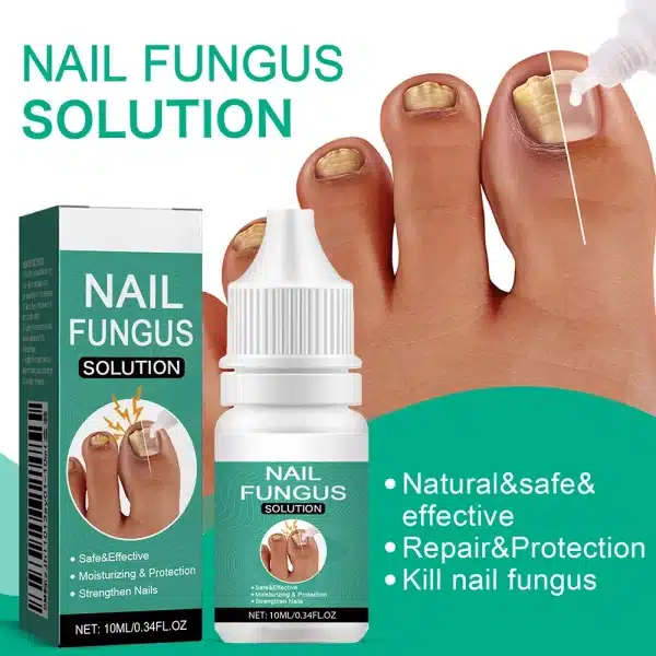 Extra Strong Nail Fungus Treatment Serum Essence Oil Feet Nails Repair Care Essence Cream Anti Infection Toe Fungal Removal Gel