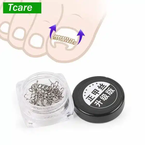 Tcare 1Set Fixer Pedicure Recover Ingrown Toenail Correction Wire Fixer Ingrown Toe Corrector Pedicure Treatment Foot Care Tool