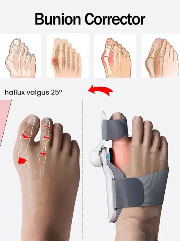 Bunion Corrector Orthopedic Toe Straightener Feet Pedicure Protection Hallux Valgus Bunion Splint Corrector Tools