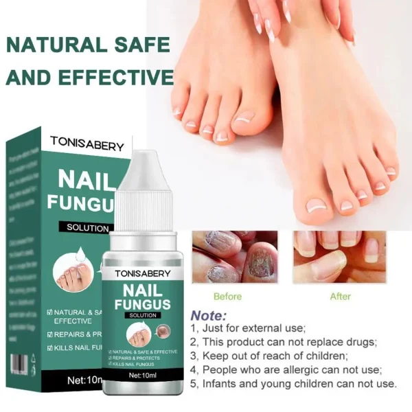 Nail Fungal Treatment Feet Care Essence Anti Infection Onychomycosis Removal Toe Nail Foot Fungus Paronychia Nail Care Body T4X8