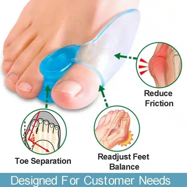 1 Pair Silicone Gel Bunion Toe Corrector Orthotics Straightener Separator Pain for Hallux Valgus Corrector De Juanetes 무지외반증