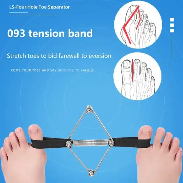 1PC Stainless Steel Toe Valgus Corrector Belt Foot Stretch Recovery Training Exerciser Strap Thumb Elastic Band Foot Tools