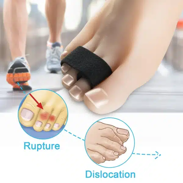 Black Toe Corrector Straightener Orthotics Wrap Cushioned Bandages Hammer Elastic Toe Separator Splints Tape Foot Care Tool - Image 4