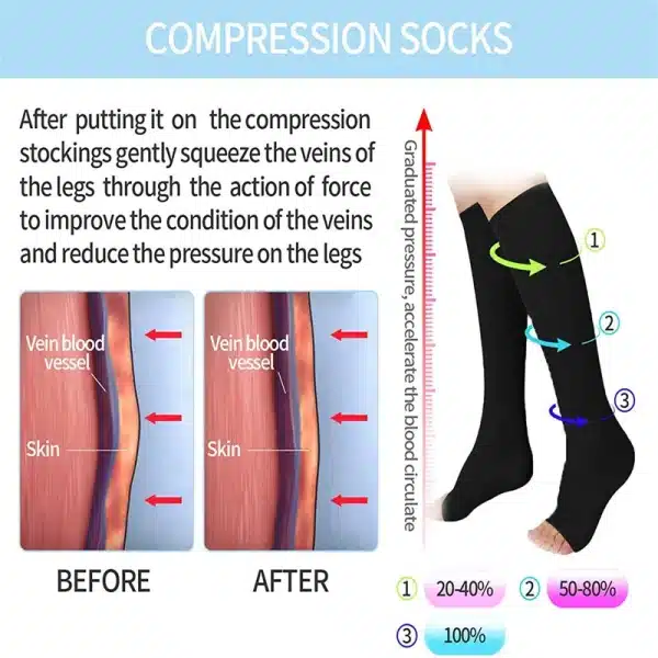 1 Pair Varicose Veins Medical Compression Stockings 23-32mmHg Pressure Level 2 Serious Calf Leg Slimming Socks Open / Close Toes - Image 2