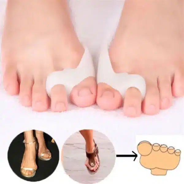 Tcare 2Pcs/Pair of Child Kids Little Toe Bunion Corrector Hallux Valgus Corrector Kids Toes Correction Feet Care - Image 3