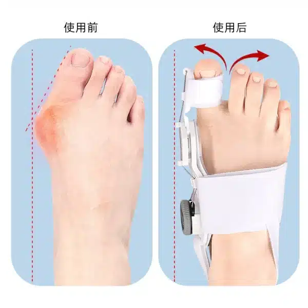 Bunion Corrector Unisex Foot Hallux Valgus Braces Rotatable Toe Separator Straightener Adjustable Pedicure Finger Toe Corrector - Image 2