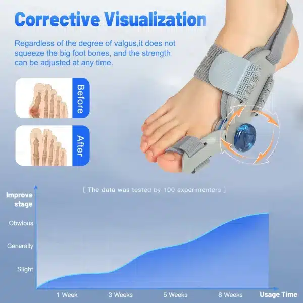 Adjustable Bunion Corrector Toe Separator Hallux Valgus Relief Toe Corrector Straightener Finger Correction Orthopedic Pedicure - Image 2