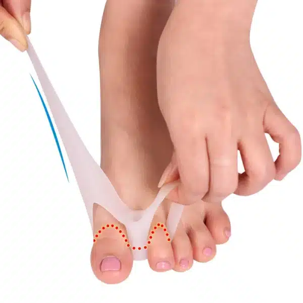 =Silicone Gel Bunion Toe Separator Spreader Eases Pain Foot Hallux Valgus Correction Massage Pedicure Tools