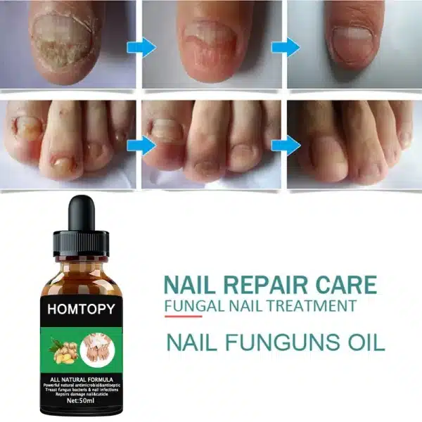 7 Days Nail Fungal Treatment Essence Oil Foot Toe Nail Fungus Removal Serum Repair Onychomycosi Anti Infection Gel Care Products - Image 4