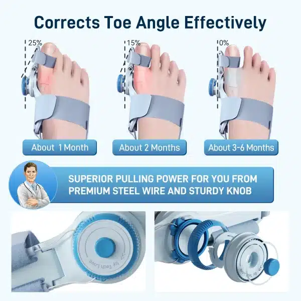 Bunion Corrector for Women & Men,Adjustable Knob Bunion Corrector for Women Big Toe,Bunion Splint for Bunion Relief - Image 6