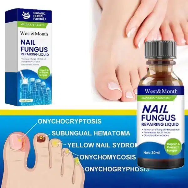 Fungal Nail Treatment Removal Oil Foot Fungus Repair Essence Toe Fungus Removal Gel Anti Infection Onychomycosis Essenice - Image 2