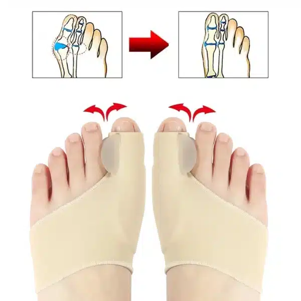 Toe Separator Hallux Valgus Bunion Corrector Orthotics Feet Bone Thumb Adjuster Correction Pedicure Sock Straightener - Image 3