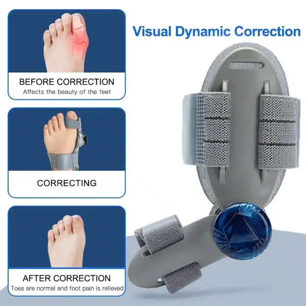 Adjustable Hallux Valgus Big Toe Corrector Orthopedic Bunion Corrector Splint Toe Separator Splint Straightener Foot Care - Image 4