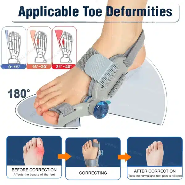 Adjustable Bunion Corrector Toe Separator Hallux Valgus Relief Toe Corrector Straightener Finger Correction Orthopedic Pedicure - Image 3