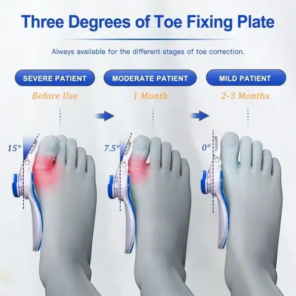 Big Toe Straightener Corrector Bunion Corrector Adjustable Toe Separator Hallux Valgus Orthopedic Brace Pain Relief Foot Care - Image 3